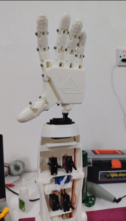 Design of upper Limb arm bond with EMG a